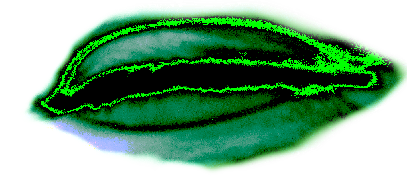 eye1
